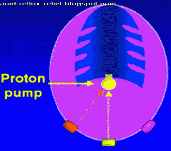 Acid Reflux Relief by Proton Pump Inhibitors image
