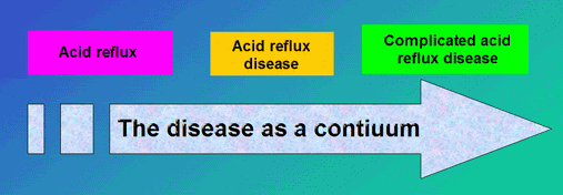 progress of acid reflux disease image