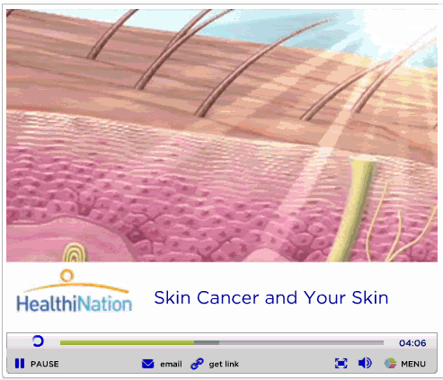 Skin Cancer Video
